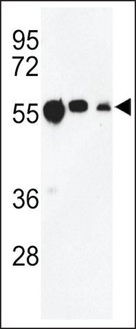 ANTI-TBB1 antibody produced in rabbit