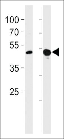 ANTI-TBX4(N-TERMINAL) antibody produced in rabbit