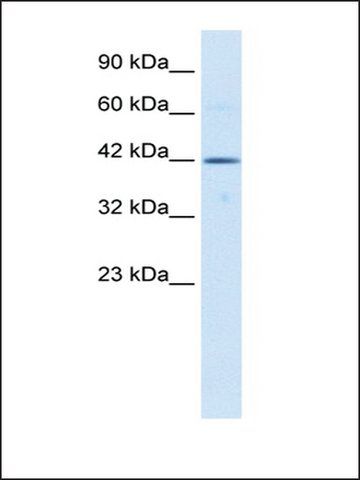 Anti-TBX6 (AB1) antibody produced in rabbit