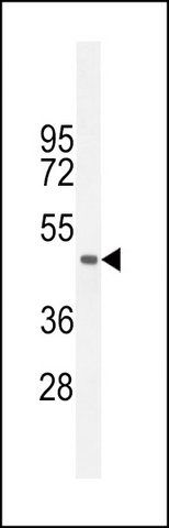 ANTI-TCAG7.977 (CENTER) antibody produced in rabbit