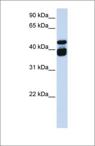 Anti-TBX6 antibody produced in rabbit