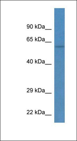 Anti-TEKT3 antibody produced in rabbit