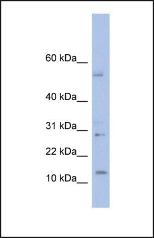 Anti-TD1 antibody produced in rabbit