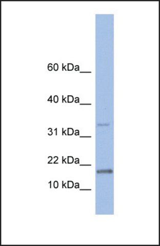 Anti-TCL1A, (N-terminal) antibody produced in rabbit