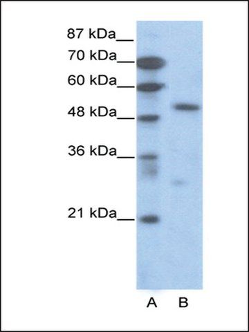 Anti-TCF7 (AB3) antibody produced in rabbit