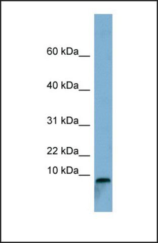 Anti-TCTA antibody produced in rabbit