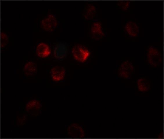 Anti-TCTEX1D1 antibody produced in rabbit