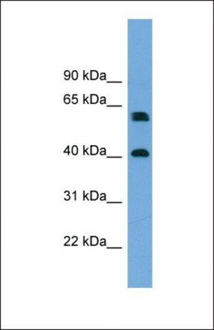 Anti-TERF2IP antibody produced in rabbit