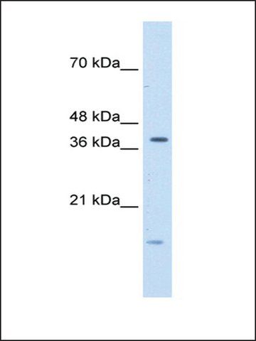 Anti-TFB2M (AB2) antibody produced in rabbit