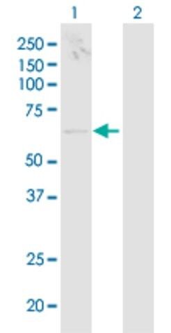 Anti-TCIRG1 antibody produced in mouse