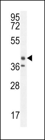 ANTI-TECTB (N-TERM) antibody produced in rabbit