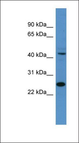 Anti-TFDP1 antibody produced in rabbit