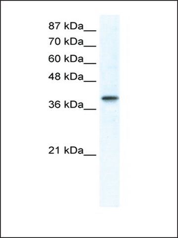 Anti-TCFAP4 antibody produced in rabbit