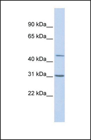 Anti-TEAD3 antibody produced in rabbit