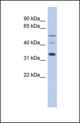 Anti-TCP11 antibody produced in rabbit