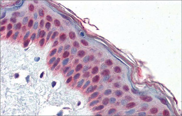 Anti-TCF7L1, (N-terminal) antibody produced in rabbit