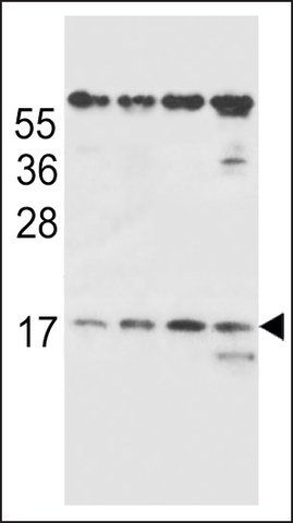 ANTI-TCRB (CENTER) antibody produced in rabbit