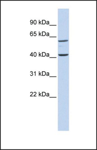 Anti-TCTN3 antibody produced in rabbit