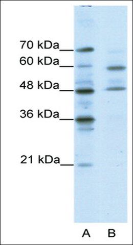 Anti-TFCP2L1 (AB2) antibody produced in rabbit