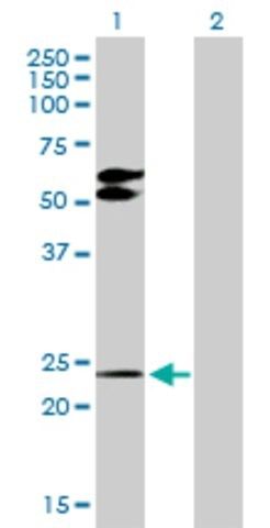 Anti-TGIF2 antibody produced in rabbit