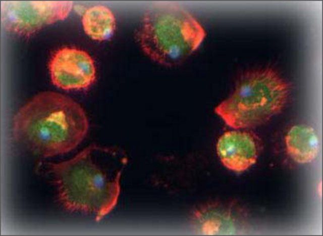 Anti-TFPI2 antibody produced in rabbit