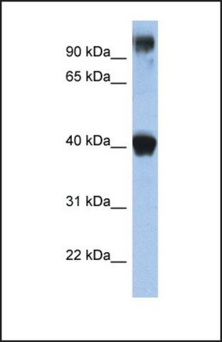 Anti-TFAP2E, (N-terminal) antibody produced in rabbit