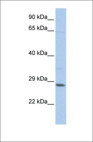 Anti-TGIF2LX (ab2) antibody produced in rabbit