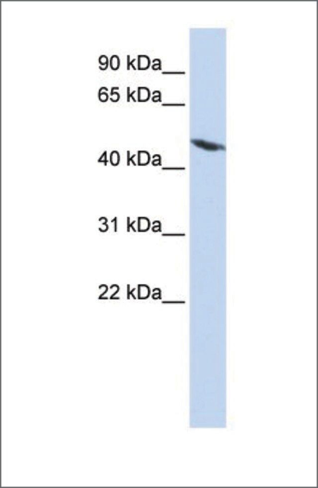 Anti-TEKT4 (ab2) antibody produced in rabbit