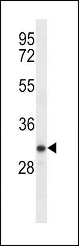 ANTI-TESSP1 (CENTER) antibody produced in rabbit