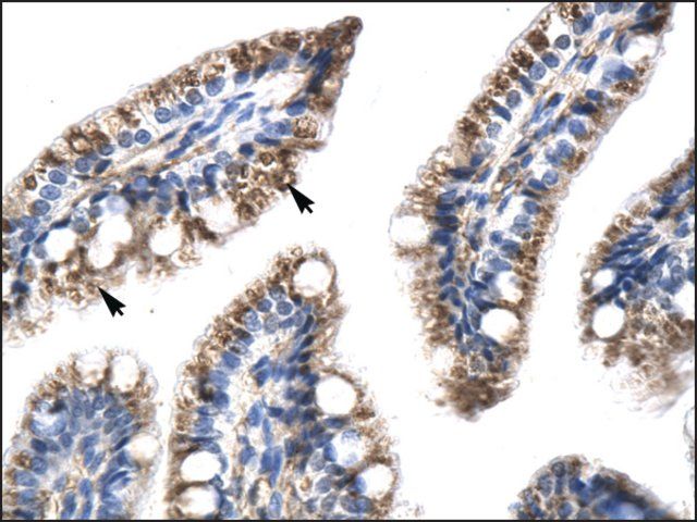 Anti-TFDP1 antibody produced in rabbit