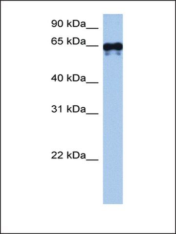 Anti-TGM6 antibody produced in rabbit