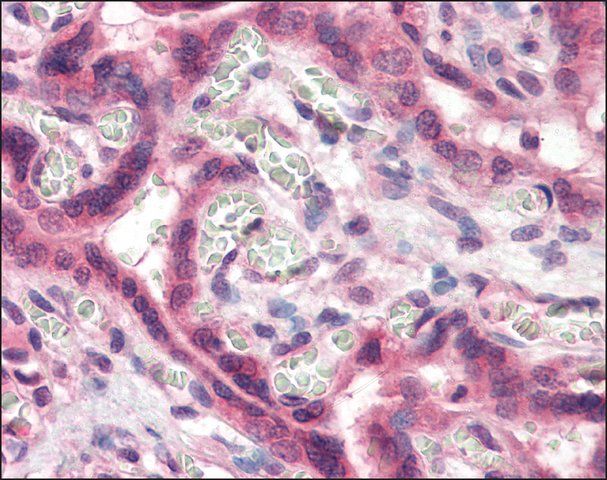 Anti-TFF2 antibody produced in rabbit