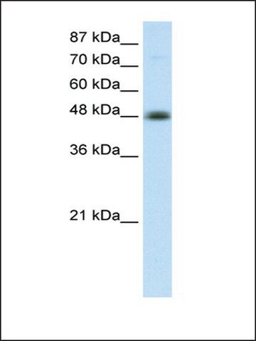 Anti-TFAP2B antibody produced in rabbit