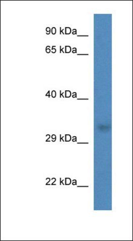 Anti-THG1L antibody produced in rabbit