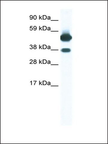 Anti-THRB (ab1) antibody produced in rabbit