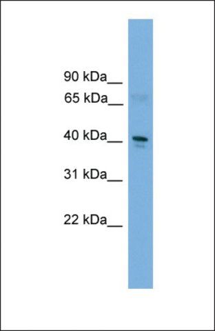 Anti-TFDP2, (C-terminal) antibody produced in rabbit