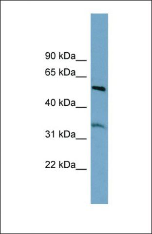 Anti-THNSL2 antibody produced in rabbit