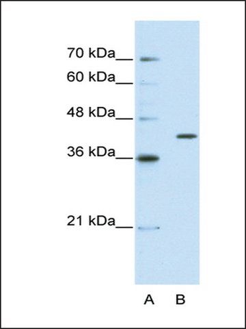 Anti-THEX1 antibody produced in rabbit