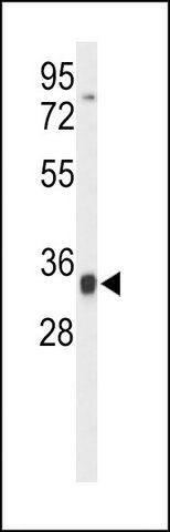 ANTI-TFPT (N-TERM) antibody produced in rabbit