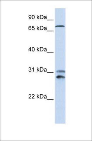 Anti-TLK2 antibody produced in rabbit