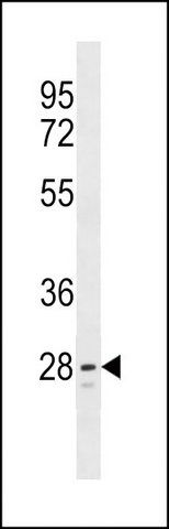 ANTI-TLCD1 (C-TERM) antibody produced in rabbit