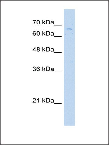 Anti-TKTL2 antibody produced in rabbit