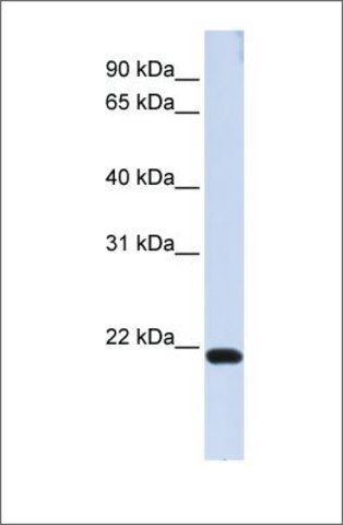 Anti-TJAP1 (ab2) antibody produced in rabbit