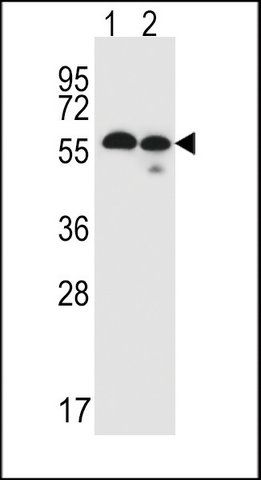 ANTI-TMEM87B (C-TERM) antibody produced in rabbit