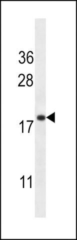 ANTI-TMM70(C-TERMINAL) antibody produced in rabbit