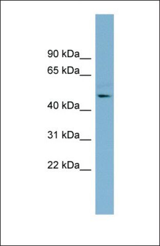 Anti-TMLHE antibody produced in rabbit