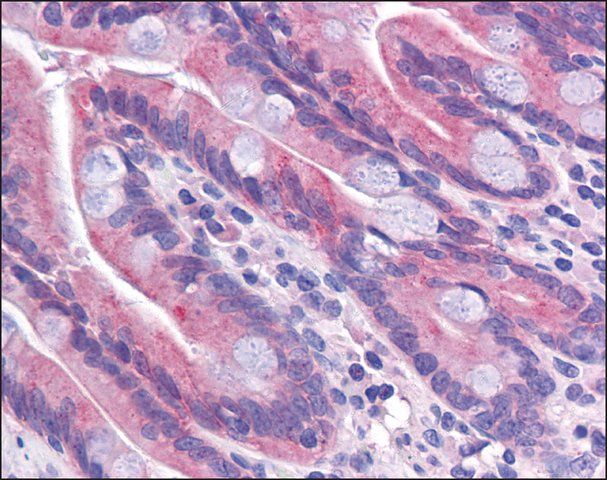 Anti-TMEM70 antibody produced in rabbit