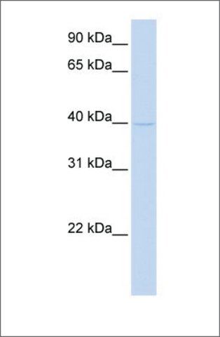 Anti-TMOD2 antibody produced in rabbit