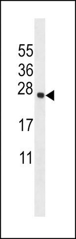 ANTI-TMM18 (CENTER) antibody produced in rabbit