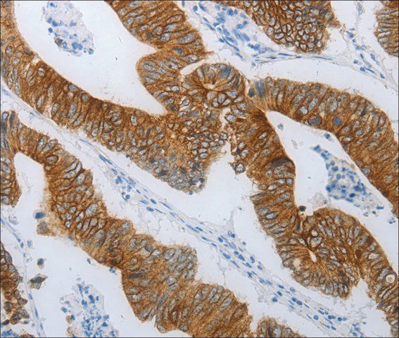 Anti-TMEM8B antibody produced in rabbit